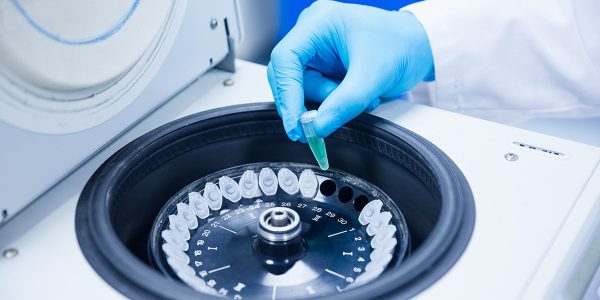 PABC centrifuge